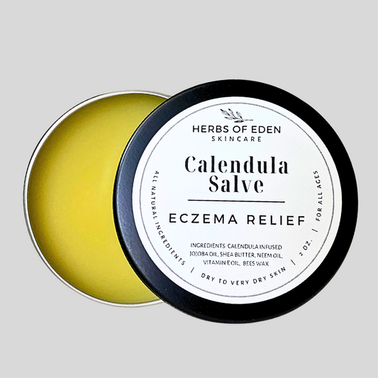 Healing Calendula Salve | 2 oz